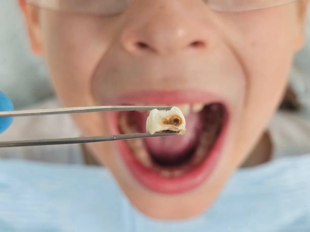 Best Weekend Emergency Dentist in Big Stone Gap, VA